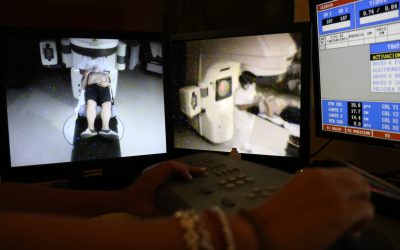 El Virgen del Rocío participa en un estudio multicéntrico sobre una técnica de irradiación craneal que reduce el riesgo de metástasis cerebral por cáncer de pulmón
