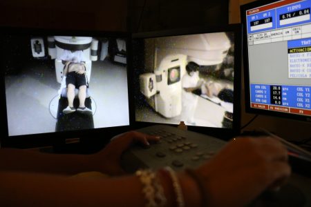 El Virgen del Rocío participa en un estudio multicéntrico sobre una técnica de irradiación craneal que reduce el riesgo de metástasis cerebral por cáncer de pulmón