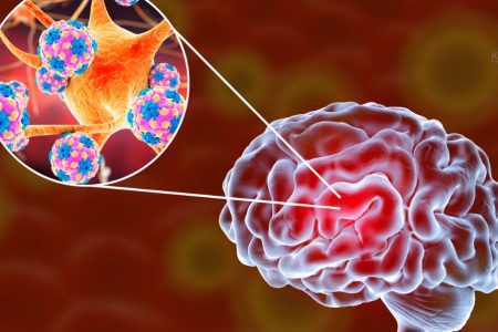 Jornada sobre Meningitis Meningocócica en España en el Horizonte 2030: Un documento de opinión