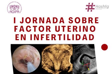 I Jornada sobre Factor Uterino en Infertilidad