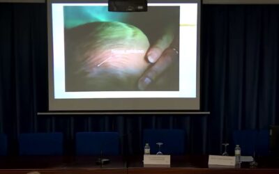 Conferencia «Lesiones dermatológicas tumorales más frecuentes en Atención Primaria»